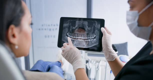 Licensed Wisdom Tooth Removal service in San Leandro, CA - Smile Center Dentistry